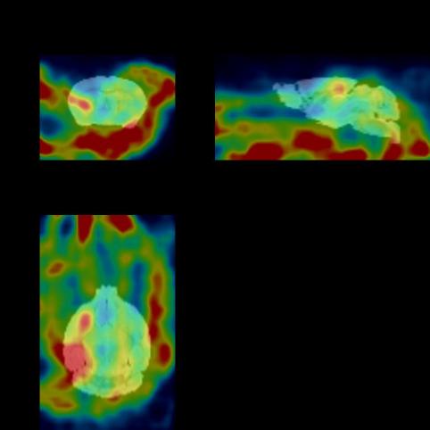  2024.11.17-C57 Mouse-Normal 1 